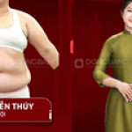 Profile picture of Giảm béo bằng liệu pháp cao sử dụng công nghệ tiên tiến giúp loại bỏ mỡ thừa an toàn, không cần phẫu thuật. Hiệu quả có thể kéo dài tùy vào cơ địa và lối sống sau liệu trình.